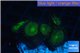 Palythoa neon green 3-4 cm WYSIWYG acclimaté