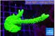 Acropora neon green 4-6 cm WYSIWYG acclimaté
