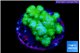 Pocillopora verrucosa toxic green 2-3 cm WYSIWYG acclimaté