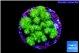 Pocillopora verrucosa toxic green 2-3 cm WYSIWYG acclimaté
