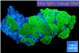 Rhodactis neon green 8-12 cm WYSIWYG acclimaté