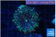 Ricordea yuma red green 1 polyp WYSIWYG acclimaté