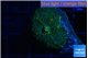 Rhodactis green gold 1 polyp WYSIWYG acclimaté