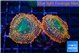 Rhodactis red blue superman 2 polyps WYSIWYG acclimaté