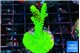 Acropora neon green 3-5 cm WYSIWYG acclimaté