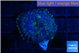 Rhodactis purple Tonga 1 polyp WYSIWYG acclimaté