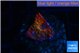 Rhodactis red blue 1 polyp WYSIWYG acclimaté